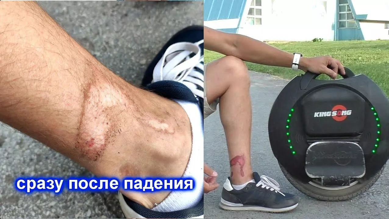 Травмы на моноколесе которые вы получите
