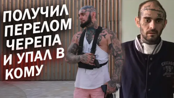 Пережил перелом черепа в ДТП. Моноколесо отключилось на скорости